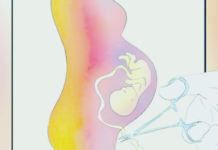 बिस वर्ष नपुग्दै ६३ जना अविवाहित युवतीबाट गर्भपतन